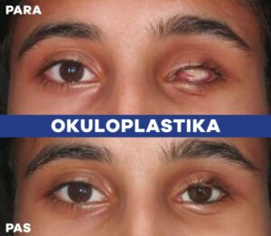 Oculoplasty services